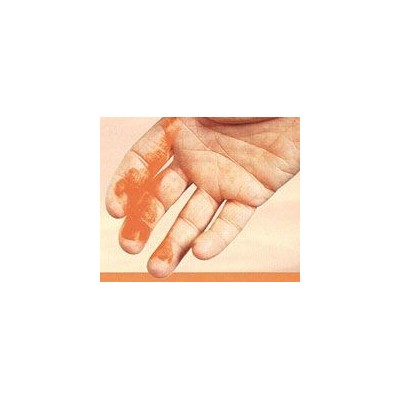 GEL REACTIVO PIEL VISIBLE